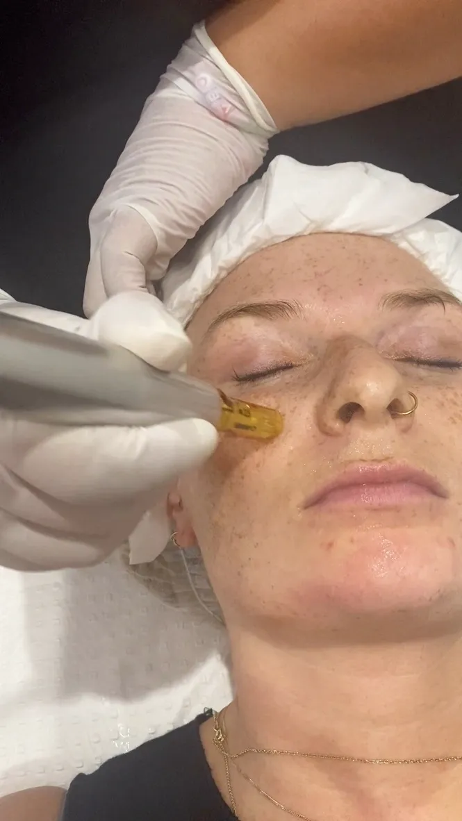 summer skin care routine — aGlo Salon & Skin Clinic Sunshine Coast