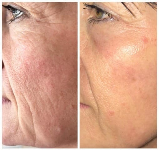 aGlo Salon & Skin Clinic